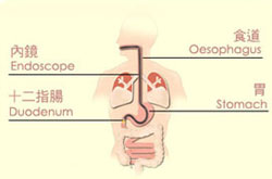 Gastroscopy Gastroscopy